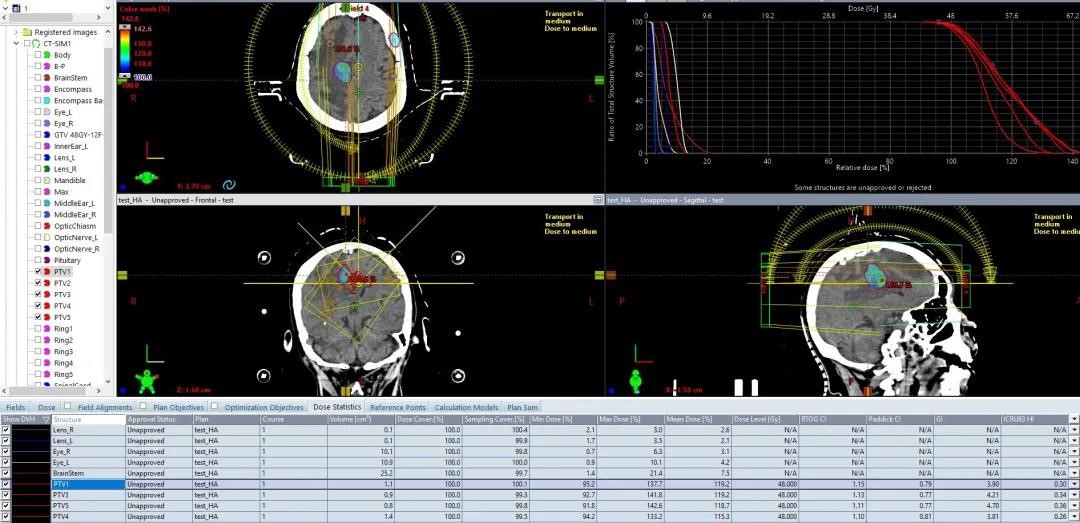 HyperArc_clinical_treatment_in_TrueBeam