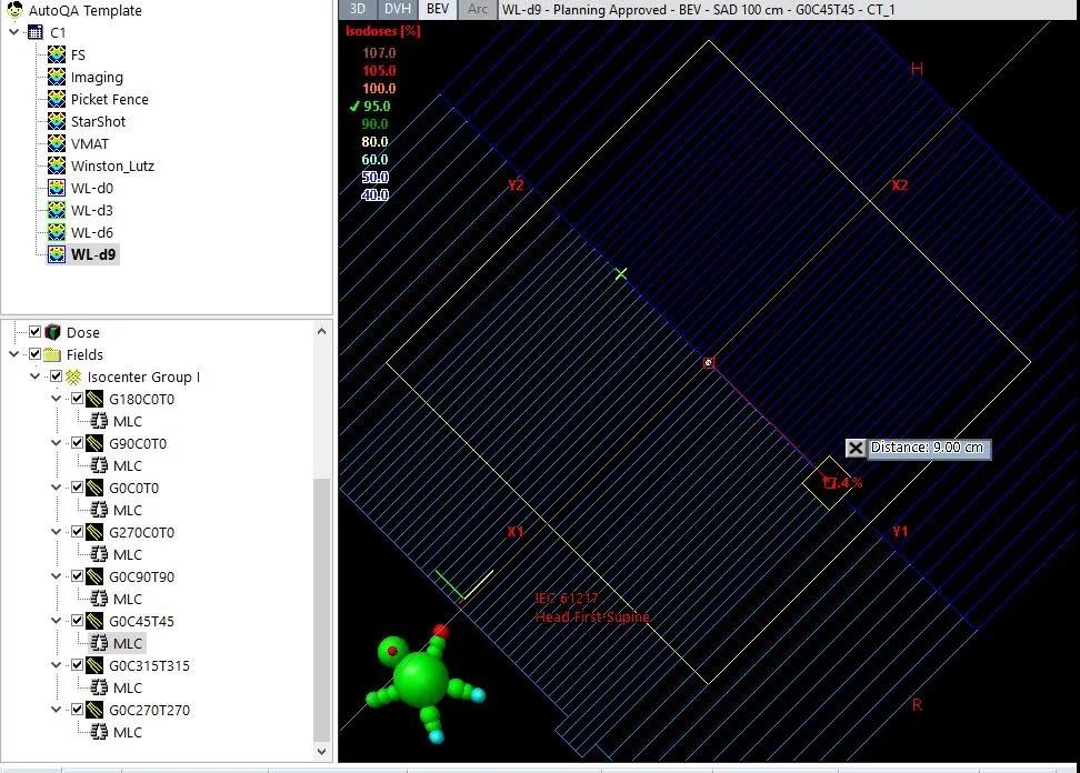 HyperArc clinical treatment in TrueBeam