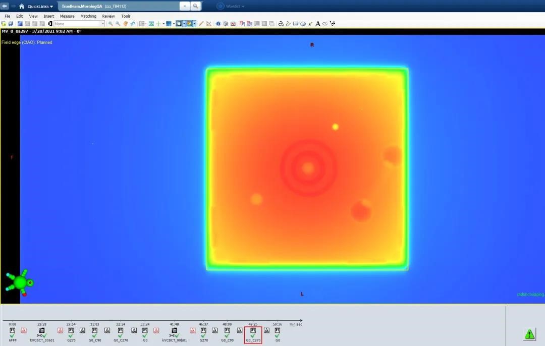 HyperArc clinical treatment in TrueBeam