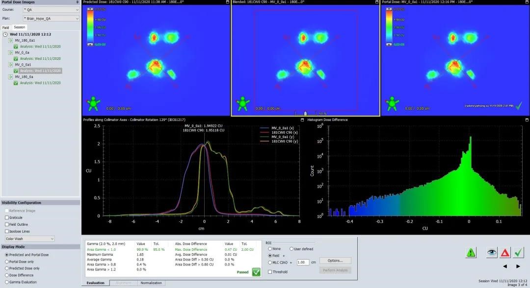 HyperArc clinical treatment in TrueBeam